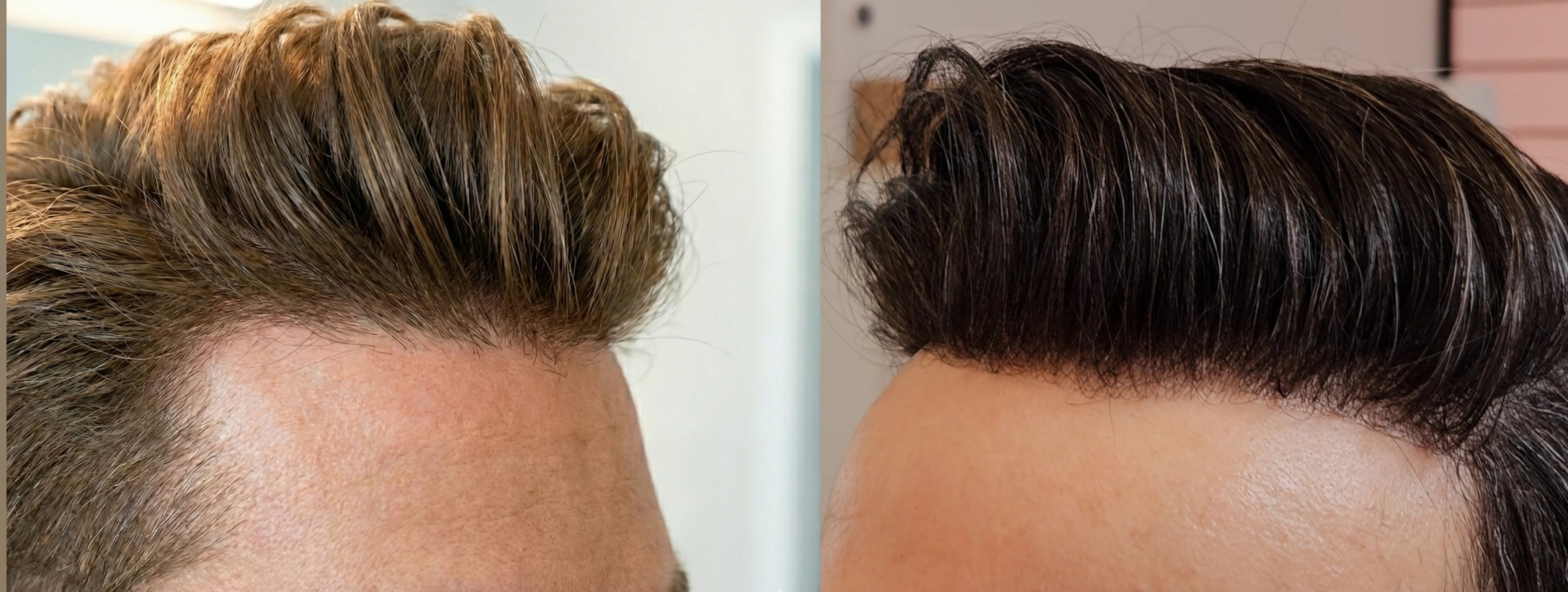 Mann mit perfekt gestyltem Haarsystem ohne Studio
